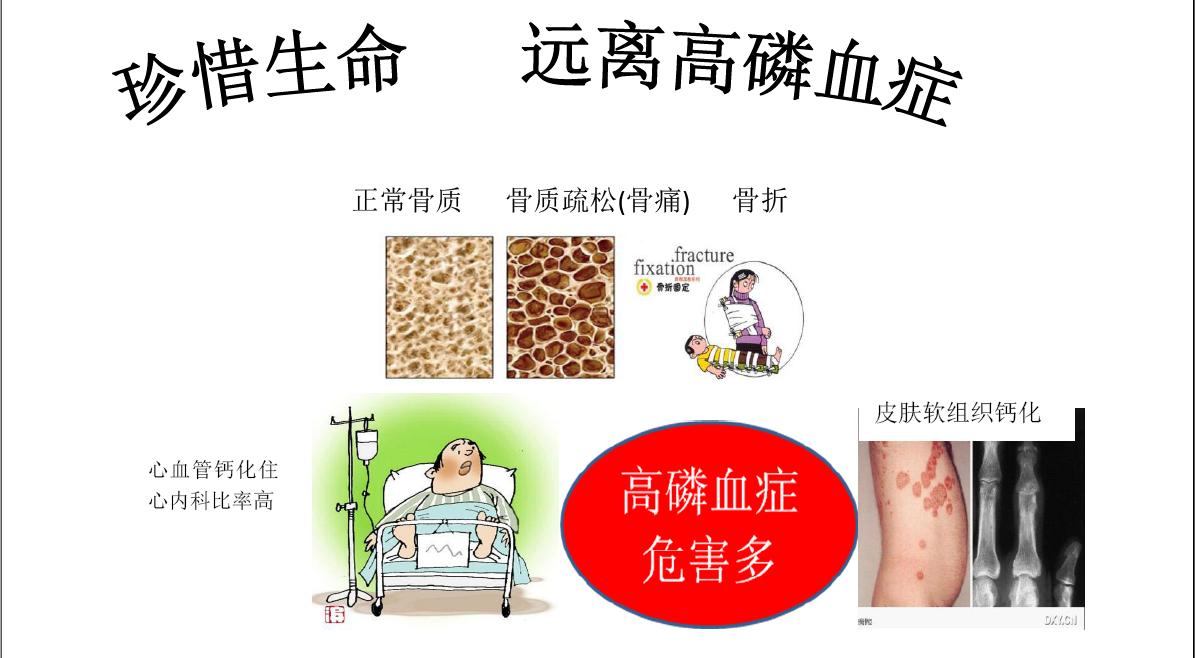 珍惜生命远离高磷血症